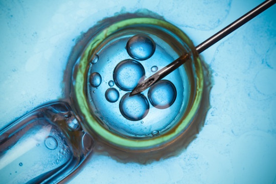 Fertilizarea in vitro (FIV): scop, rata de succes, stadii