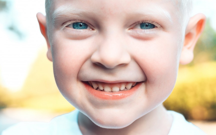 Albinismul, o maladie cu care se poate trăi? Povestea unui copilaș din Moldova