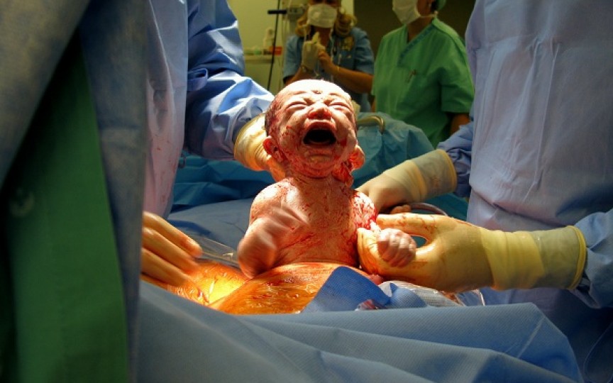 Nașterea naturală versus cezariana. Un ginecolog explică diferențele