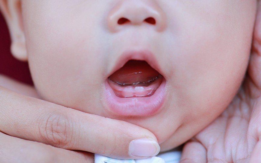 Apariția dinților de lapte – sfaturi pentru depășirea durerii de la medicul pediatru