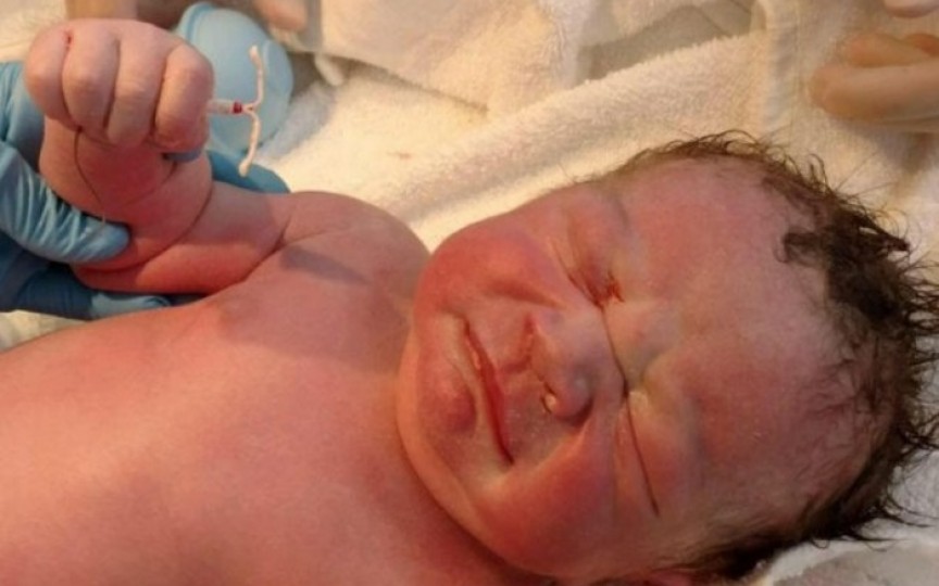 Uimitor! Un bebeluș s-a născut cu steriletul mamei în mână