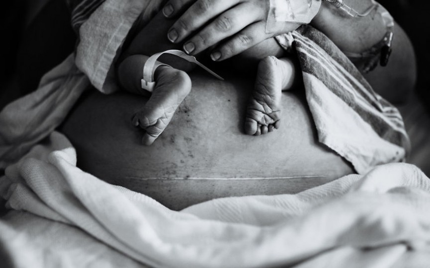 Fotografiile impresionante care au învins la Concursul despre naștere și maternitate