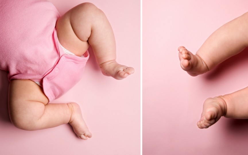 Luxaţie congenitală de şold la copii: cauze și tratament