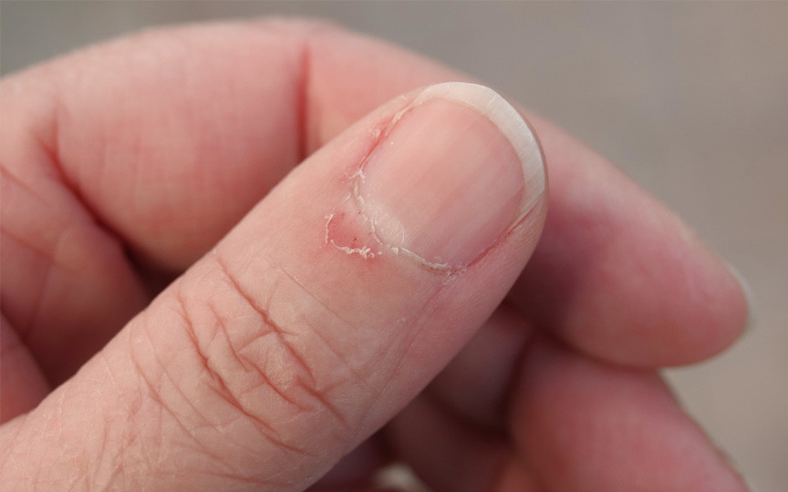 Uleiul natural din bucătărie care vindecă cuticulele uscate în doar 10 minute