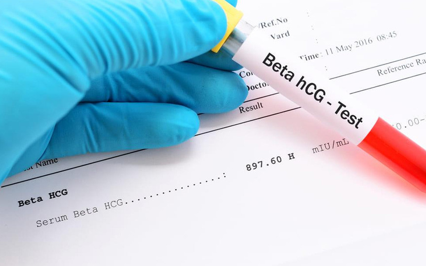 Totul despre hCG (beta-hCG): Ce este hormonul sarcinii și ce semnifică valorile sale