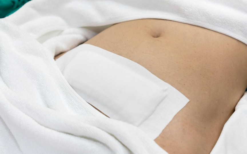 Medic ginecolog despre semnele unei infecții după o naștere prin cezariană