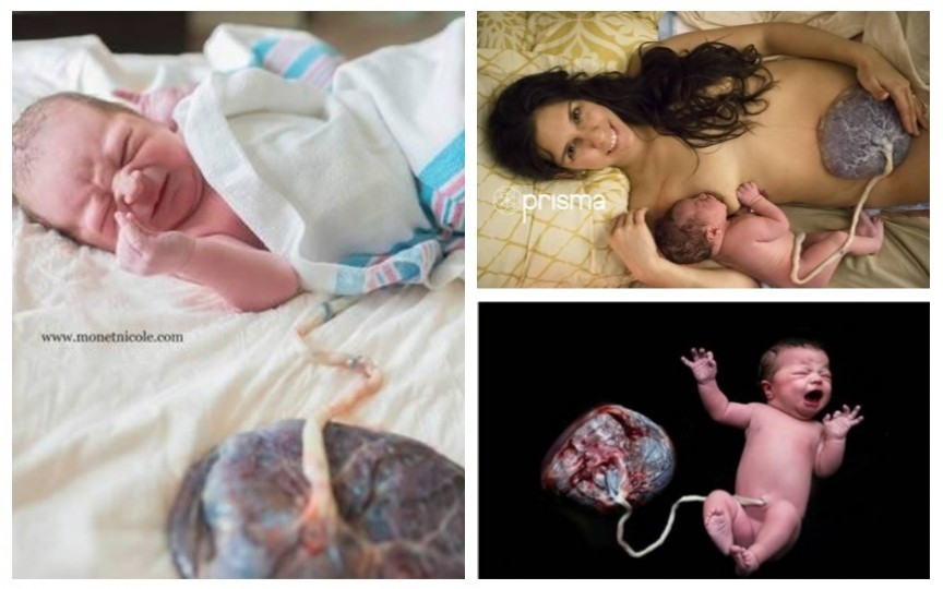 Imagini care au făcut înconjurul lumii: bebeluși și placentele lor