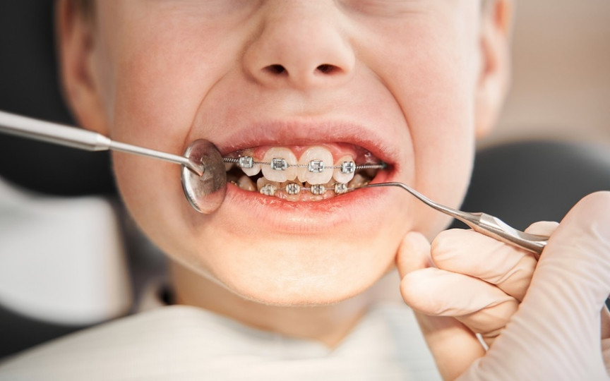 Legătura dintre alinierea dentară și postura corpului la copii