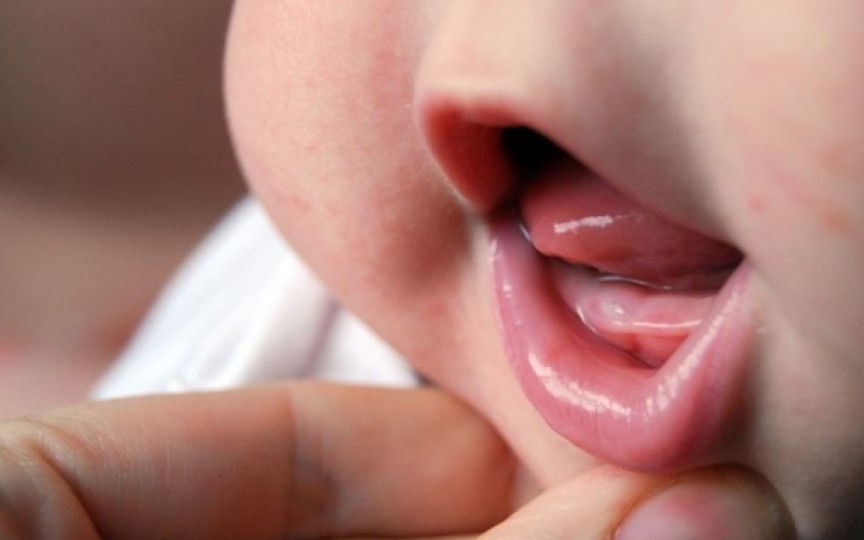 7 semne că apar primii dinţişori la bebeluș