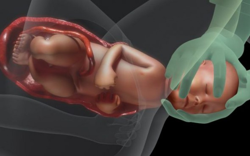 Medic obstetrician-ginecolog despre rolul bacteriilor vaginale în imunizarea nou-născuților