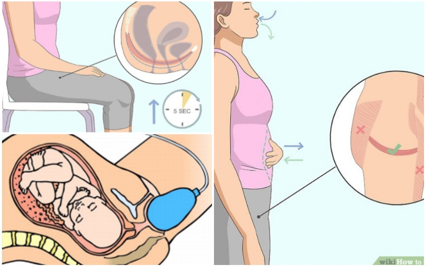 Reeducarea perineului după naștere – metode explicate pas cu pas de medicul obstetrician-ginecolog