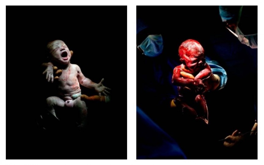 (FOTO) E emoționant cum arată bebelușii în primele clipe după naștere