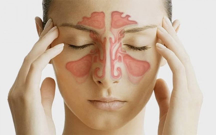 Remedii absolut naturale pentru nas înfundat
