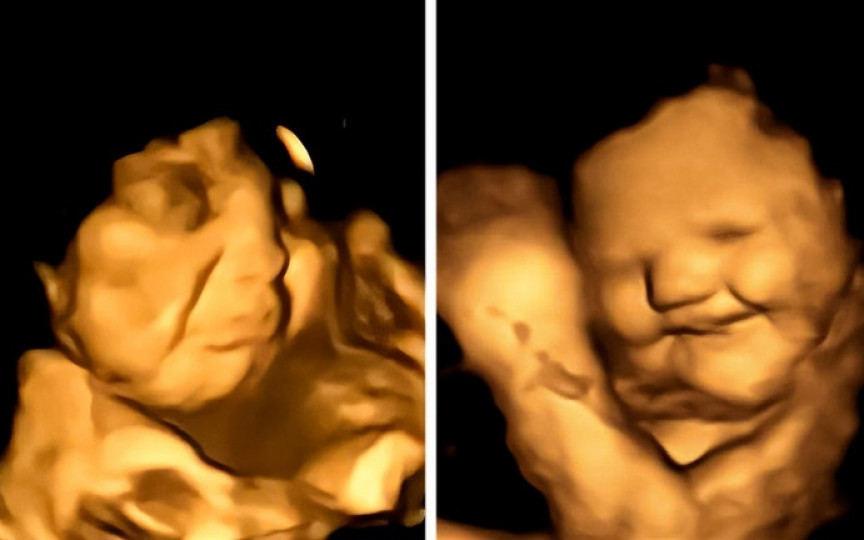 Bebelușii pot avea gust și miros în uter. Studiu: cum reacționează bebelușii nenăscuți la aromele alimentelor consumate de mamele lor.