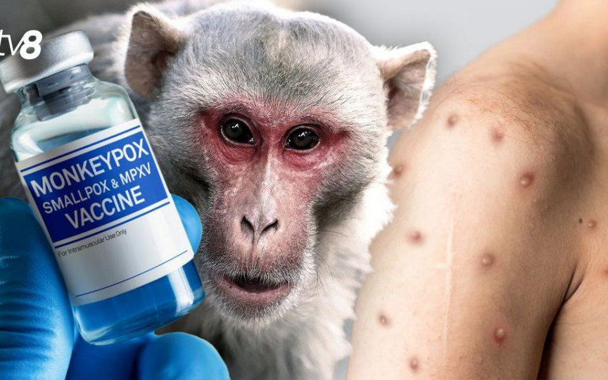 Niciun caz de variola maimuței, înregistrat în R. Moldova. Recomandările specialiștilor pentru a preveni infectarea