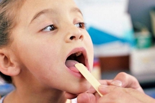 Limba zmeurie, un simptom care apare în bolile acute la copii