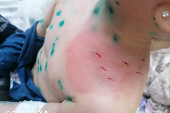Foto: Copil de 4 ani, purtat din spital în spital, operat și examinat afară