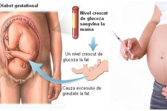 Tot ce trebuie să știi despre diabetul de sarcină (gestațional)