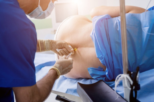 Cum să decizi dacă epidurala este potrivită pentru tine și care sunt riscurile acesteia