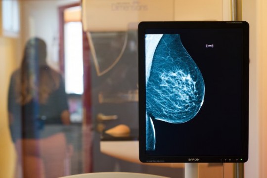 Mamografia – o necesitate. Vezi unde găsești la noi unicul utilaj de ultimă generație pentru mamografie!
