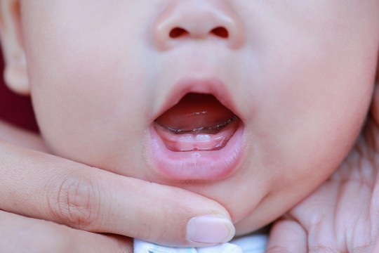 Apariția dinților de lapte – sfaturi pentru depășirea durerii de la medicul pediatru