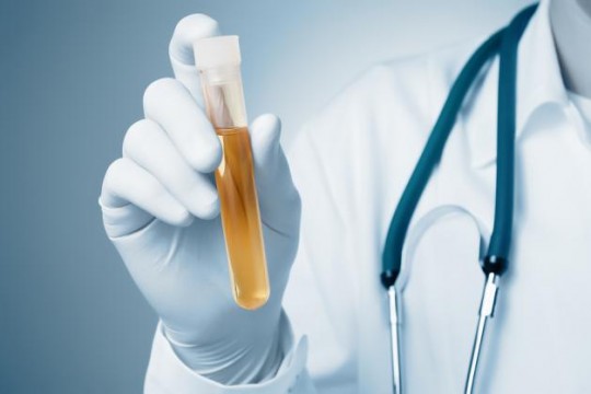 Medicul pediatru, Dorina Agachi, explică ce înseamnă leucocite în urină