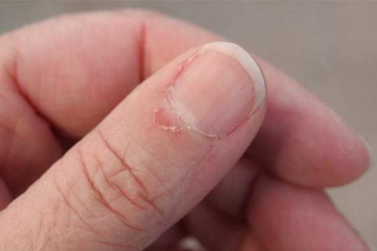 Uleiul natural din bucătărie care vindecă cuticulele uscate în doar 10 minute
