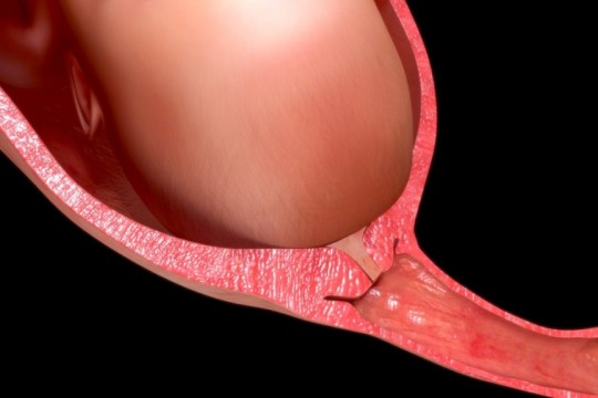 Dopul gelatinos în sarcină: cum arată, ce este, când și de ce îl pierzi