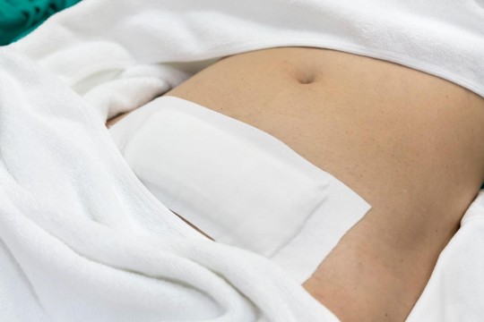 Medic ginecolog despre semnele unei infecții după o naștere prin cezariană