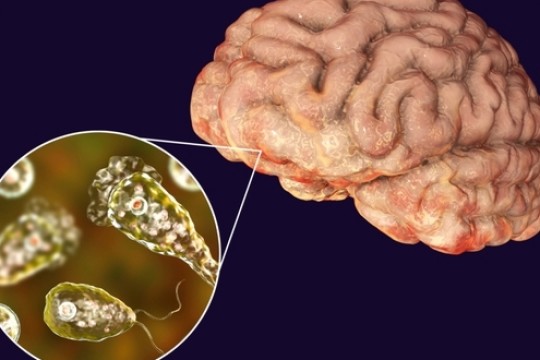 Un copil de 7 ani a murit după ce s-a infectat cu o amibă care se hrănește cu creierul uman