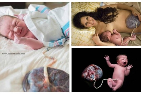 Imagini care au făcut înconjurul lumii: bebeluși și placentele lor
