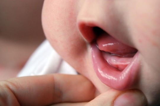 7 semne că apar primii dinţişori la bebeluș