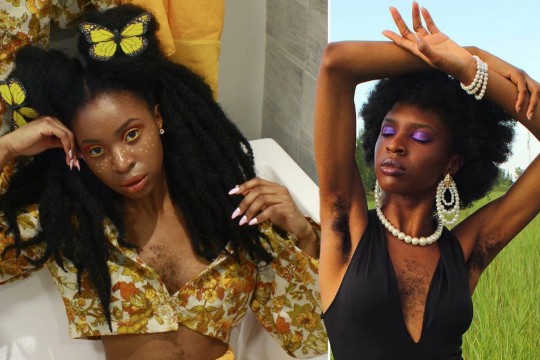 Artista cu păr pe piept militează pentru acceptarea femeilor cu aceeași problemă