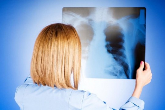 Pneumonia, netratată, poate duce la deces: simptome, cauze și factori de risc