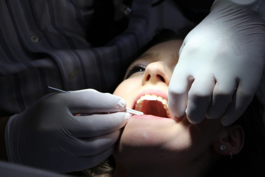 Un dentist a scăpat un ac de 4 cm în gâtul unei paciente. Femeia a fost operate de urgență