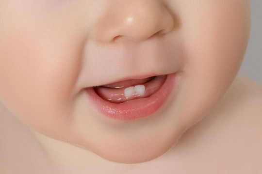 Ce strică smalțul dinților la copii și cum poate fi întărit