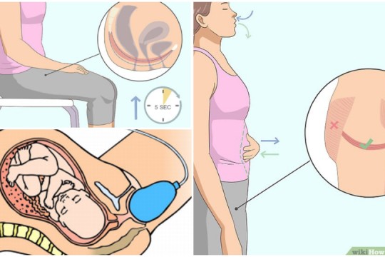 Reeducarea perineului după naștere – metode explicate pas cu pas de medicul obstetrician-ginecolog