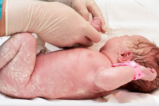Vernix caseosa: Ce este și cum protejează bebelușul în primele zile de viață