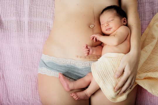 11 probleme frecvente care pot apărea după nașterea prin cezariană