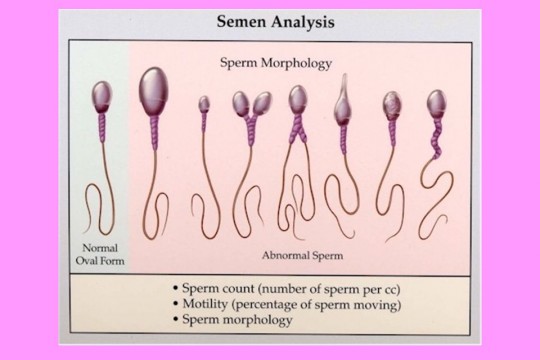 Specialist urologie-andrologie despre cele mai des întâlnite cauze ale infertilităţii la bărbaţi