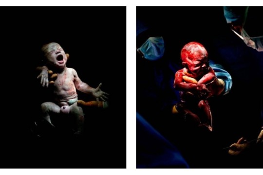 (FOTO) E emoționant cum arată bebelușii în primele clipe după naștere