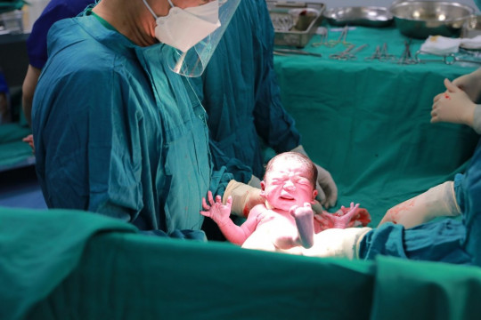 Nașterea prin cezariană – explicată în detaliu din experiența unei mămici