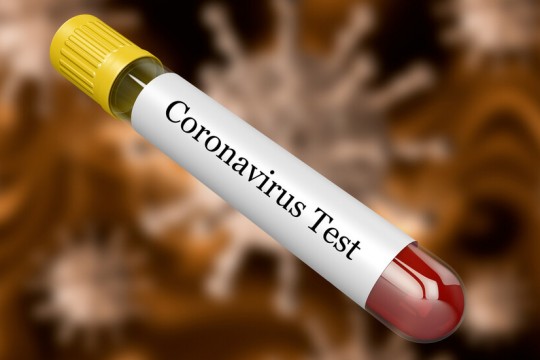 Atenționarea OMS! Mituri despre coronavirus