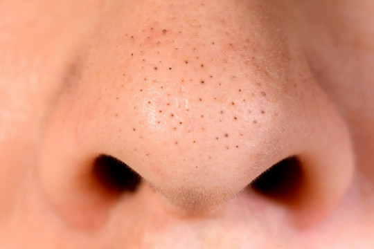 Tratament natural pentru punctele negre: exfoliant DIY cu ingrediente ieftine și eficiente
