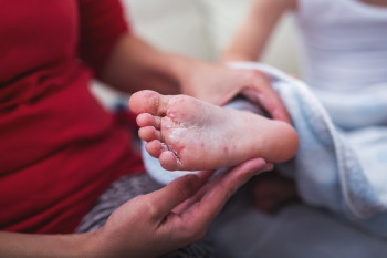 Copilul tău are boala gură-mână-picior? Iată ce ne sfătuiește medicul specialist