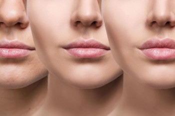 Cum îți influențează hormonii pielea: ghid complet pentru pubertate, sarcină și menopauză