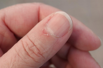 Uleiul natural din bucătărie care vindecă cuticulele uscate în doar 10 minute