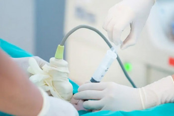 Amniocenteza în sarcină: cât de sigură este și când este recomandată