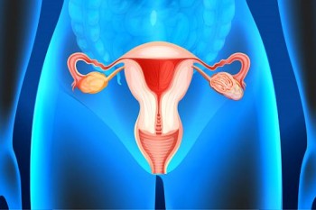 Chisturile uterine: când apar și cum pot fi eliminate