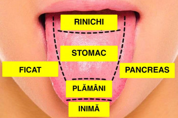 De ce îți devine limba albă și cum să scapi de această afecțiune